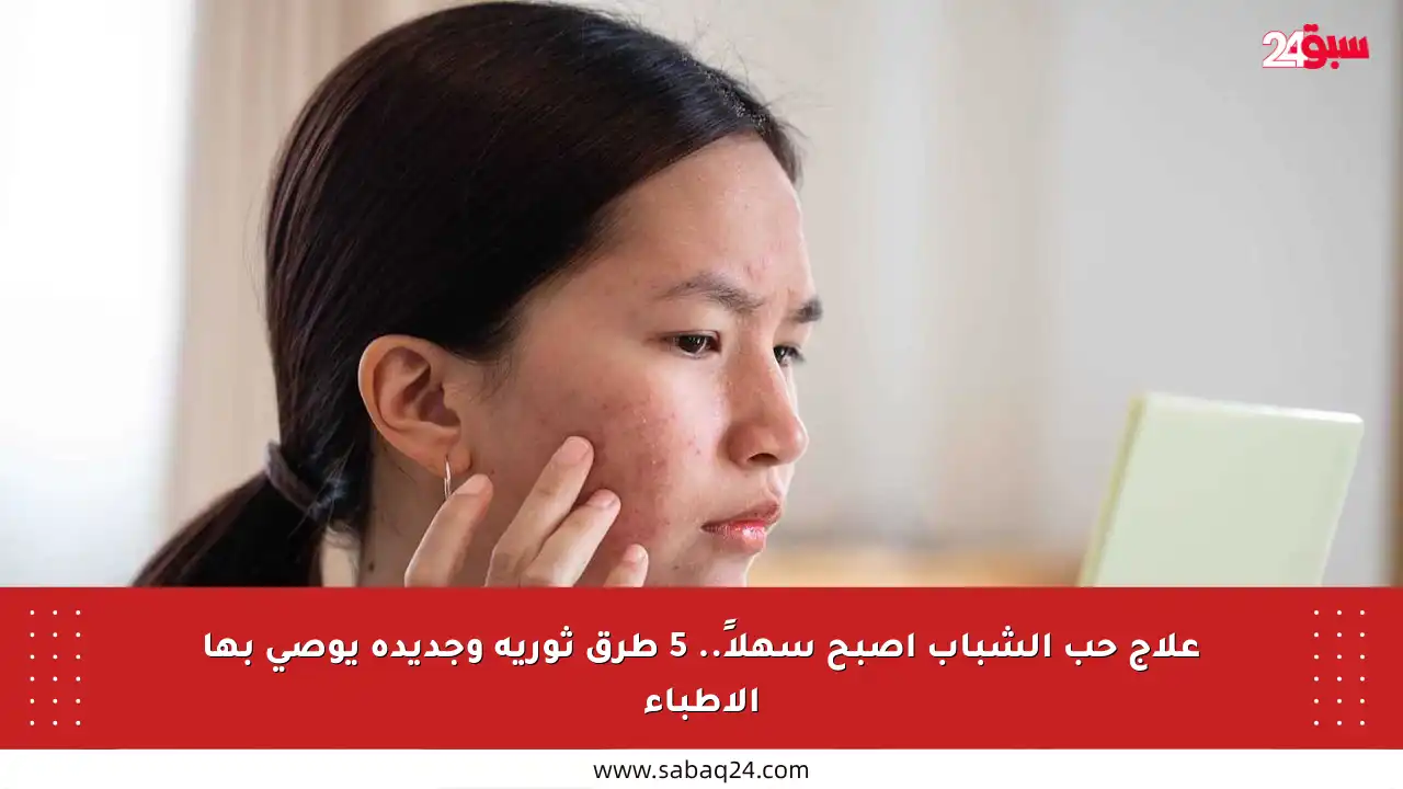 علاج حب الشباب أصبح سهلاً.. 5 طرق ثورية وجديدة يوصي بها الأطباء